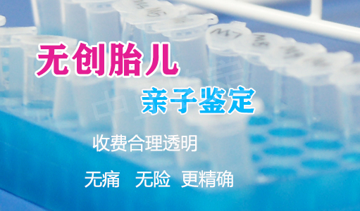 扬州胎儿亲子鉴定正规的中心到哪里,扬州孕期亲子鉴定结果准不准确 扬州胎儿亲子鉴定正规的中心到哪里,扬州孕期亲子鉴定结果准不准确